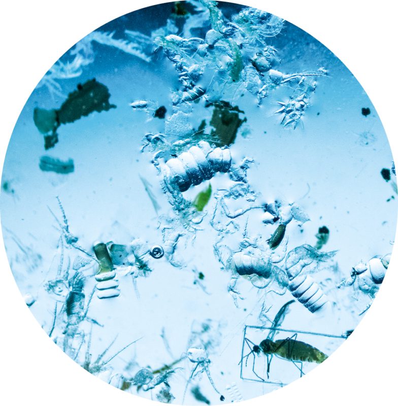 Unter dem Mikroskop: Im Rhein gefundenes Mikroplastik